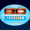 Kit Blanqueador Dental UV- LumiSmile™