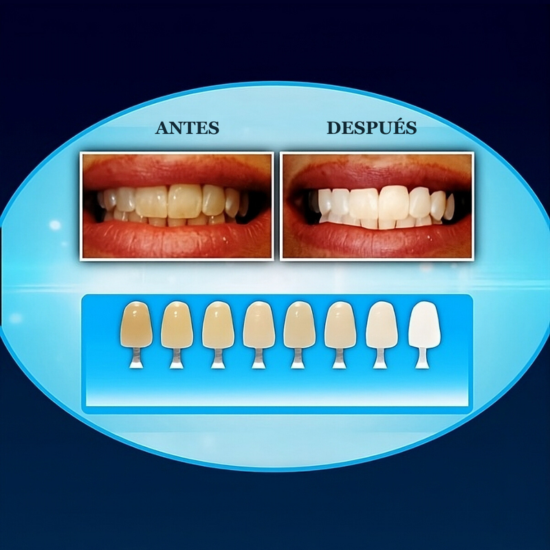 Kit Blanqueador Dental UV- LumiSmile™