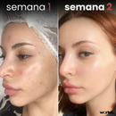 Crema Antiedad Dragón™