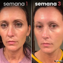 Crema Antiedad Dragón™